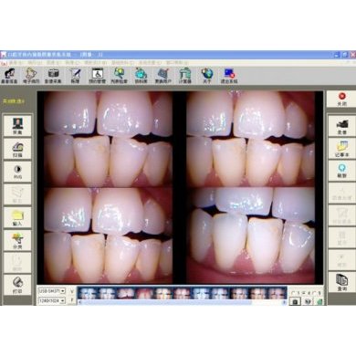 Camera Intraoral 4.0 Megapixel c/ 6 LEDs