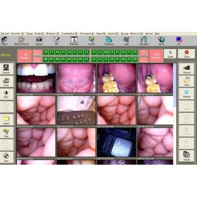 Camera Intraoral 4.0 Megapixel c/ 6 LEDs